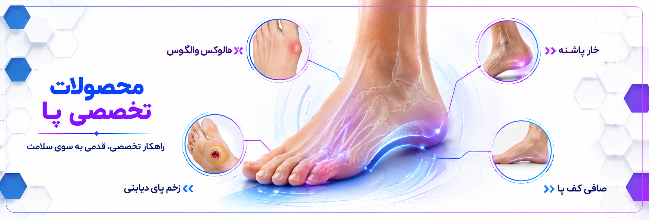محصولات تخصصی مراقبت از پا Mr Feet؛ راهکارهای تخصصی برای هالوکس والگوس، خار پاشنه، صافی کف پا و زخم پای دیابتی